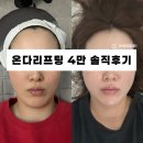 와와멍# | 연신내피부과 온다리프팅 4만줄 통증 효과 후기