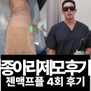 엘리피부과의원 | 당산역피부과 젠틀맥스프로플러스로 4번하고 종아리털 다 사라진 후기!