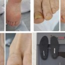 레푸스죽전새터점 | 분당 발각질 꼼꼼하게 레푸스죽전새터점 관리 후기