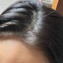 비오틴 5000, 저도 효과 있을까요? 솔직 후기