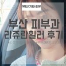 장유누가병원 | 부산 리쥬란 김해 피부과 리쥬란힐러 2cc 후기