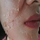 새서울메디칼 네이버블로그