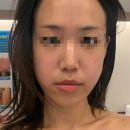 조암농업협동조합 | [대구] 대구 월성동 윤곽관리 신부관리 탄력관리 에스테틱 하울뷰티 추천