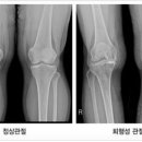 이재성한의원 네이버블로그