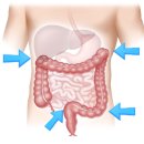 비타민신통 | 비수면 대장내시경 후기·대장 내시경 준비팁·대장 내시경 음식추천