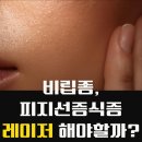 얼굴 피지선증식증 비립종 레이저하는게 좋을까? 압출 후기
