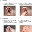 부안보청기 이미지
