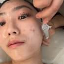 마직 | 내돈내산 평촌 피부관리실 리벨로 스킨앤왁싱 고마직플레닝 후기
