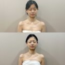 더에스테틱 수미원 - 남구 | 대구웨딩케어 성지 승모근 삭제하고 목 길어지는 더에스테틱 수미원 20대 윤곽 관리 솔직후기