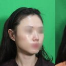 유리움한의원 네이버블로그