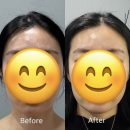 씨스페이스포항양덕점 | 두피케어부터 리프팅까지 포항피부관리 ‘스페이스 뷰티’