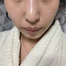 3가지 제품을 3일만에 기미가 줄어들음 유니시티화장품 네이젠 에볼루션 후기
