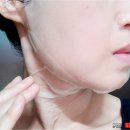 세미광고사 | 민감성 피부를 위한 어성초마스크 완벽한 케어! 상떼화장품 아카마스크(Feat.아카 세미겔 마스크) 소개