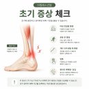 아킬레스