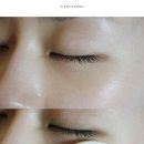 림팩트 이미지