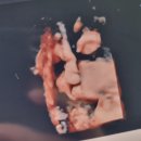 노블산부인과의원 이미지