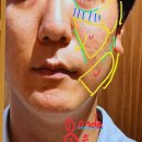 주식회사쓰임받는사람들 | 도도티비 도쌤 극초단파 온다 가격 전후사진 후기 유지기간 통증 주기