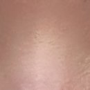 비아이오 | 쌍꺼풀 재재재재재수술 손품, 발품, 상담 후기 정리 (은하수, 비아이오,유니크,올로,강남서연,티에스)