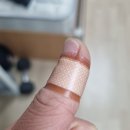 포항의료원 | [포항 외과 추천] 손 베여서 피가 안 멈출 때, 포항의료원 봉합술 후기