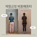 류필라테스 | [흑석 산전산후 필라테스]류OO 회원님의 필라테스 비포애프터 후기