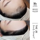 제이비라인 이미지