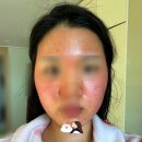 동그라미약국 | 울트라클리어 클리어모드 내돈내산 자세한 후기