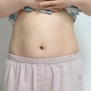 칼로핏 - 제천시 청풍호로 49 | 종로 복부 지방분해주사 칼로핏주사 명동 피부과 내돈내산 솔직후기