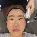 강남피부과의원 - 북구 호계로 332-1 | 강남피부과 튠페이스30kJ 후기 올피채 강남의원에서 얼굴리프팅 받은 내돈내산 솔직후기