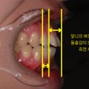 서울 가지런이 치과교정과 치과의원 이미지