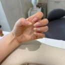 로우번네일(Lowburn Nail)