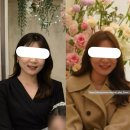 10-A | 내돈내산 약손명가 맞춤관리A 10회 비포애프터 후기