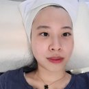 비니드헤어 이미지