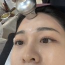 홍 헤어라인 네이버블로그