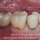 세인트치과 네이버블로그