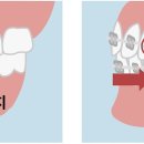 확실한강치과의원 이미지