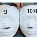 에스테틱,오늘 이미지