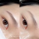 아인뷰티의원 이미지