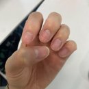 시너지원팩 6년차 매니아가 기다려온 '트루글로', 습진으로 쭈글했던 손톱 매끈해진 리얼 내돈내산 후기