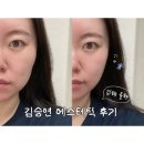 GS25율하희망점 | 김해율하수기관리 김승연 에스테틱 추천, 피부관리부터 윤곽리프팅까지 근막관리 후기