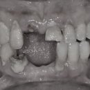 On(온)치과기공소 이미지