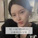 청담 아이업눈꺼풀실리프팅 후기 붓기 및 통증