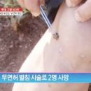 봉침 효능 : 벌침먹으면 효능 주의할 건 이거 이미지