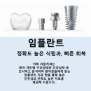 라임치과의원 | [순천 라임치과 의원] 임플란트를 앞두고 계신다면 ?