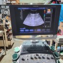 Siemens Sonovista X300 premium edition with 2 probes 이미지