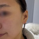 안산대학로 | 안산중앙동 더맑은스킨｜바이옴 닥토필로 맑아진 피부결 후기