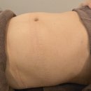현대고수가스 | 부산 사하구 다대포 피부관리 여름맞이 복부슬리밍관리로 만족한 리움에스테틱 재방문 후기