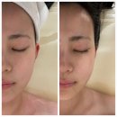 영종도 웨딩케어 윤곽, 피부관리 &#39;예스테라피&#39;