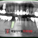 매일디지털치과의원 이미지