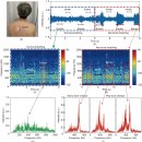 Tele-medicine 원격진료 시대 -- COPD 관리 방법 AI 청진, 기침소리, HRV, 호흡수, 산소포화도 이미지