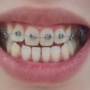 비에스의원 이미지